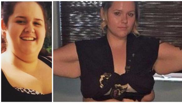 Impactante transformación de mujer que perdió 79 kilos y pudo lucir bikini por primera vez (FOTOS)