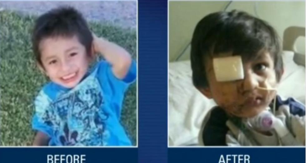 Pitbull ataca a un niño y miles de personas se oponen al sacrificio del perro