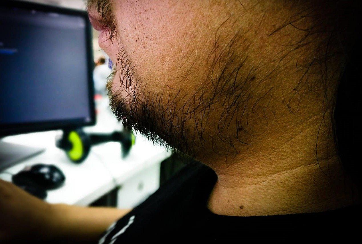 ¿Cómo dejar de tener papada y grandes cachetes sin recurrir a la cirugía?