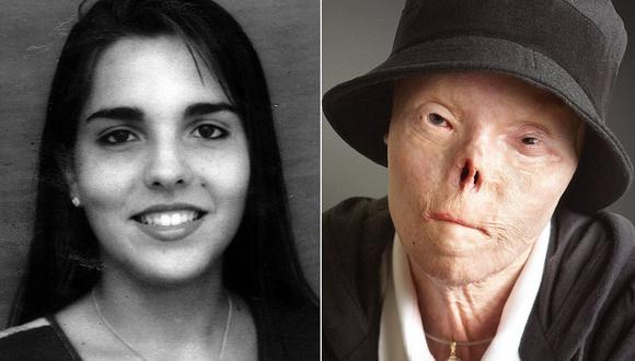 Dejó de existir la mujer venezolana que se convirtió en el rostro de las tragedias por los conductores ebrios (FOTOS)