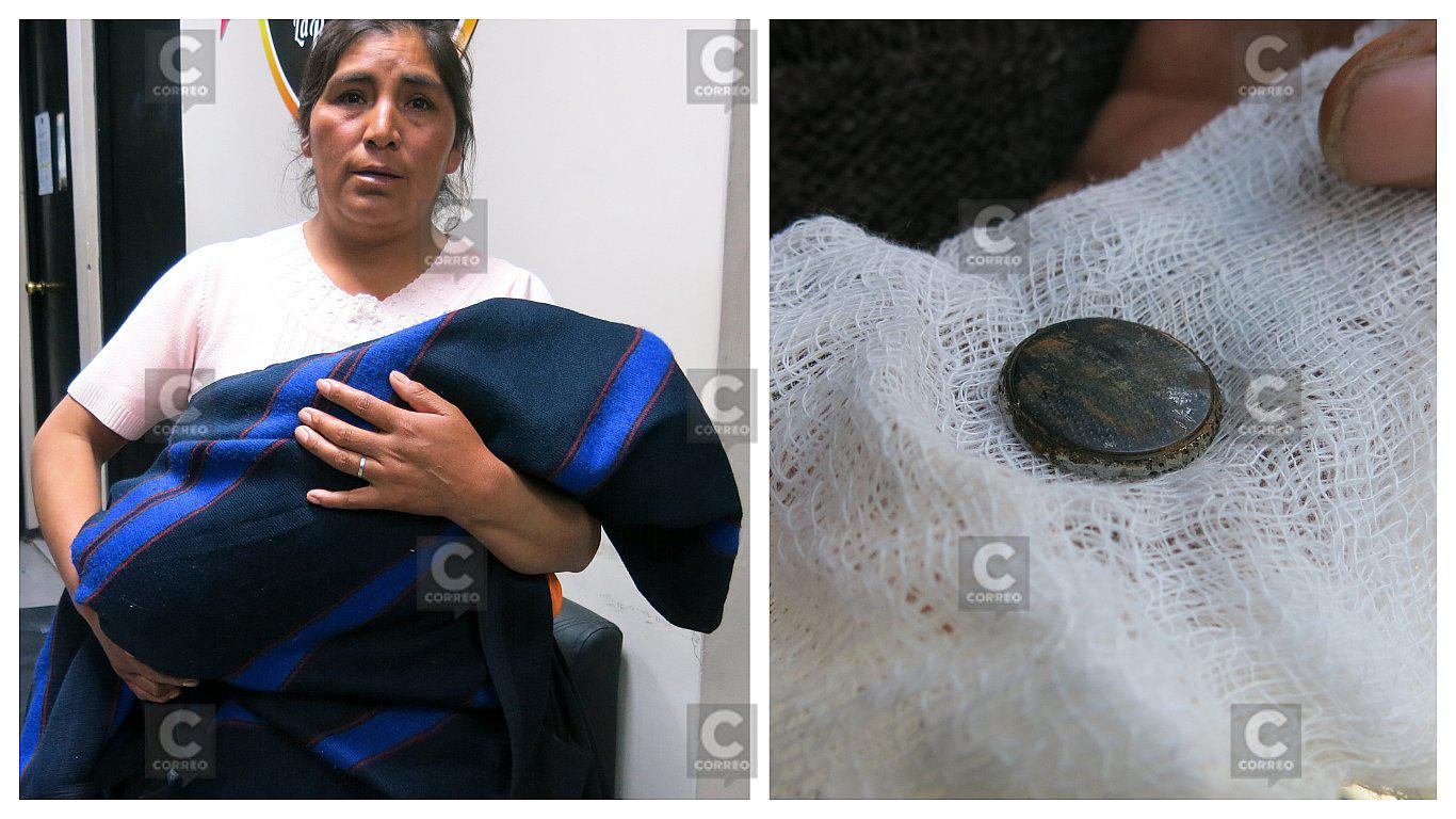 ​Niño que tragó pila recibirá tratamiento especializado en Lima