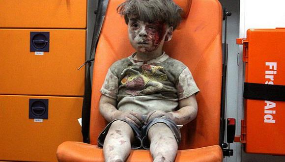 Así está ahora Omran Daqneesh, el niño símbolo de la guerra en Siria (FOTOS)