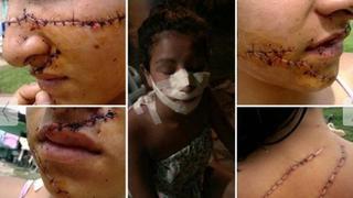 Argentina: Hermanas desfiguran rostro a bella quinceañera