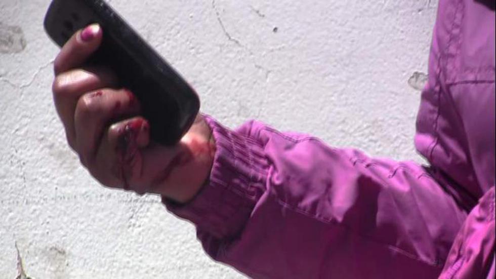 Perro rottweiler ataca a niño de 9 años