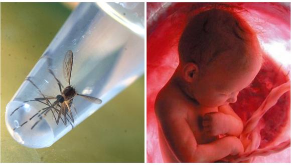 Zika: La presencia de virus en suero materno sí infecta al feto