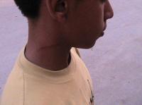 Menor se salva de morir degollado 