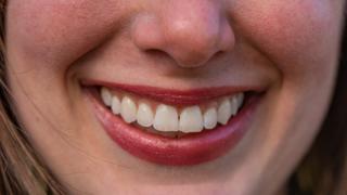 Trucos caseros sencillos para blanquear los dientes de forma natural