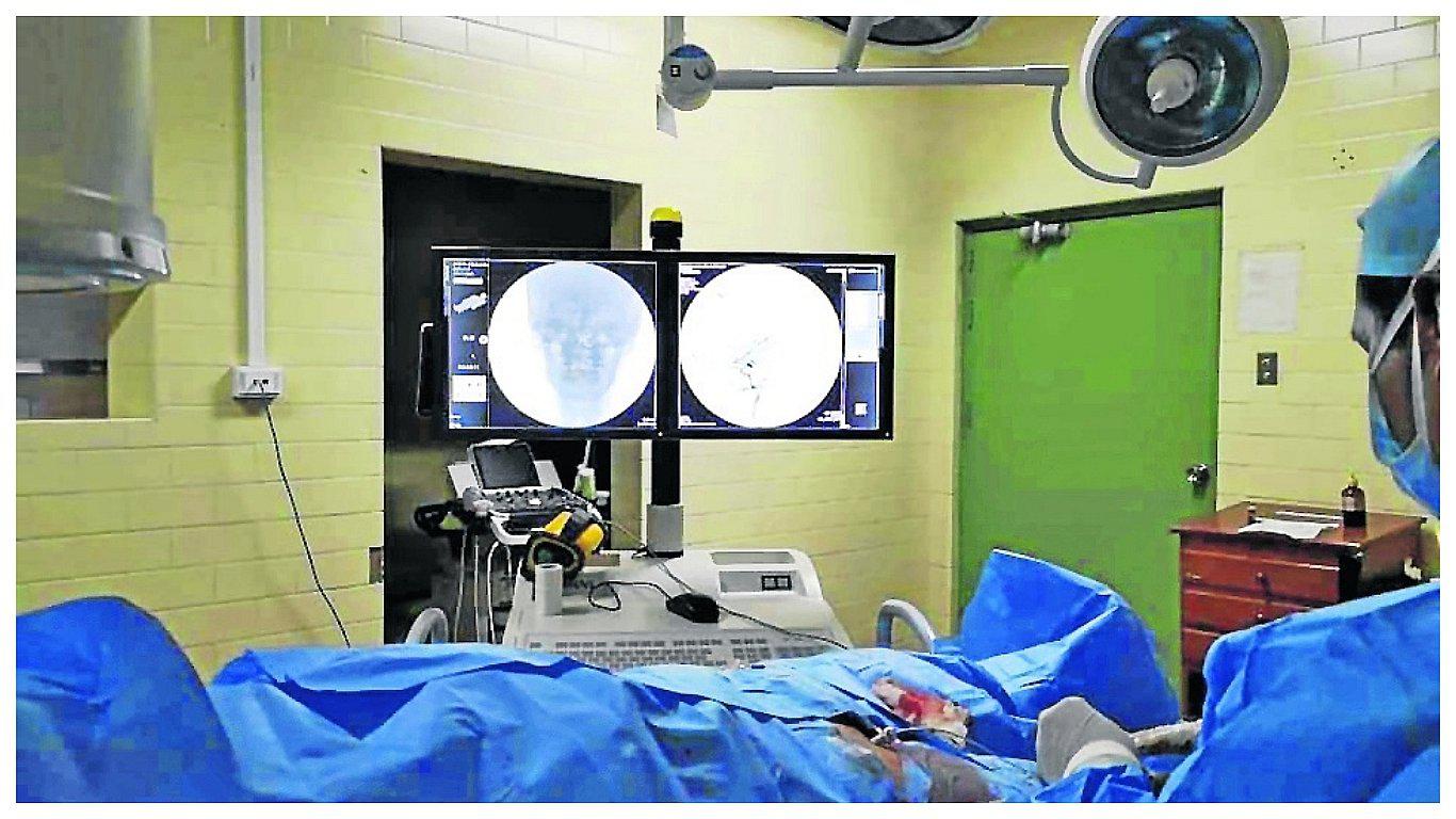 ​Por primera vez realizan procedimiento de angiografía cerebral