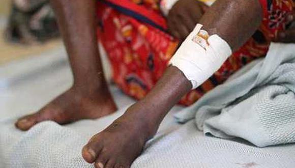 Kenia: Granada explota en zona turística y deja 10 heridos