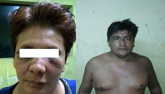 Tumbes: Otro caso de agresión a una mujer se registra en Zarumilla