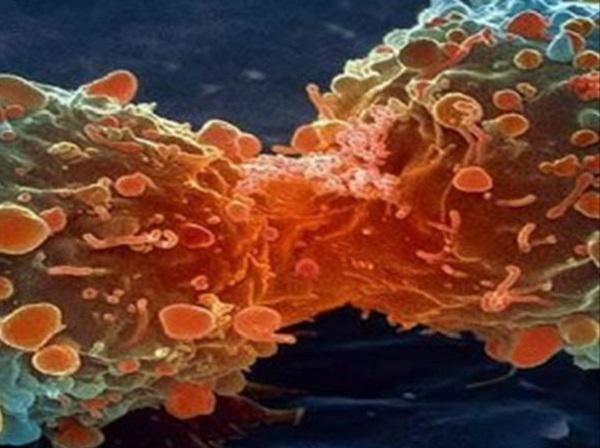 Identifican el mecanismo que hace que el cáncer cree metástasis