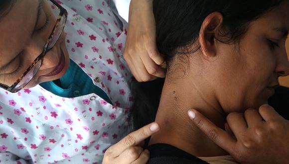 Psoriasis: Una enfermedad que afecta a medio millón de peruanos