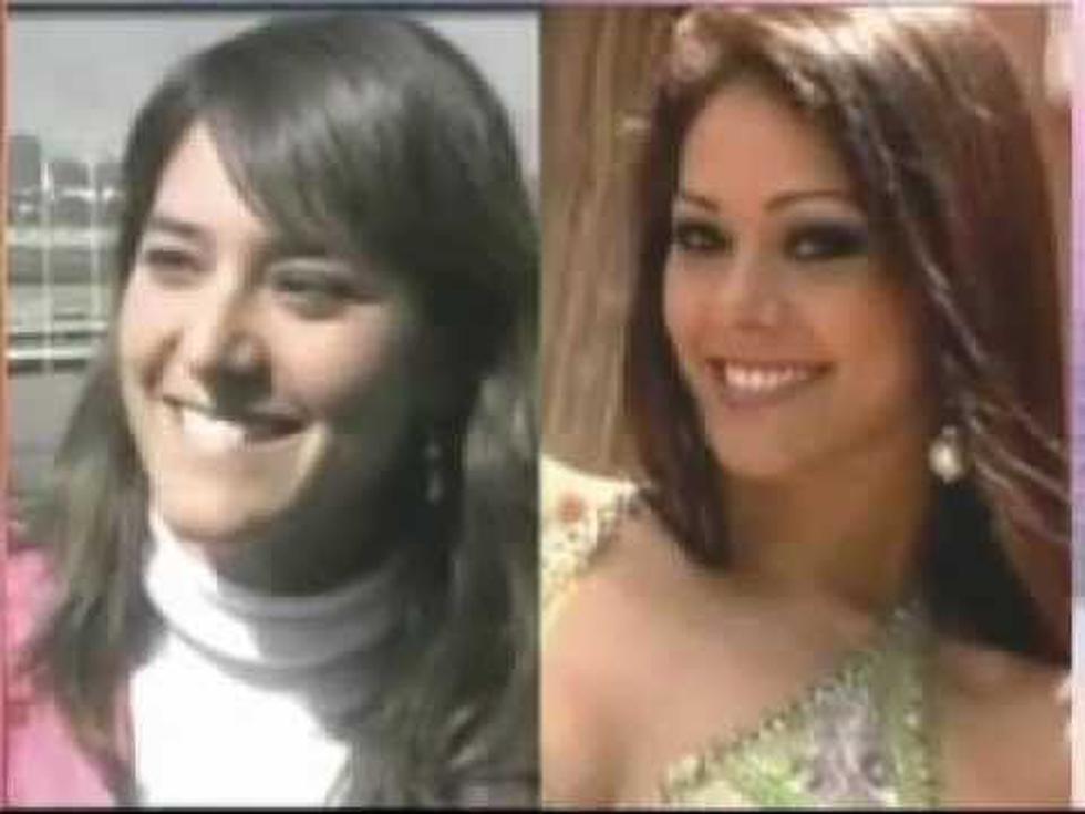 Nueva foto del antes de Karen Schwarz