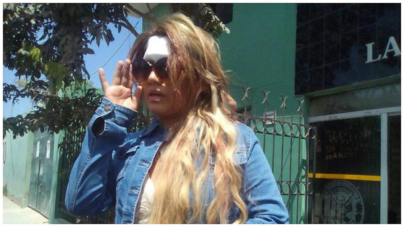 Chiclayo: liberan a hombre acusado de atacar a mujer con una botella (VIDEO)