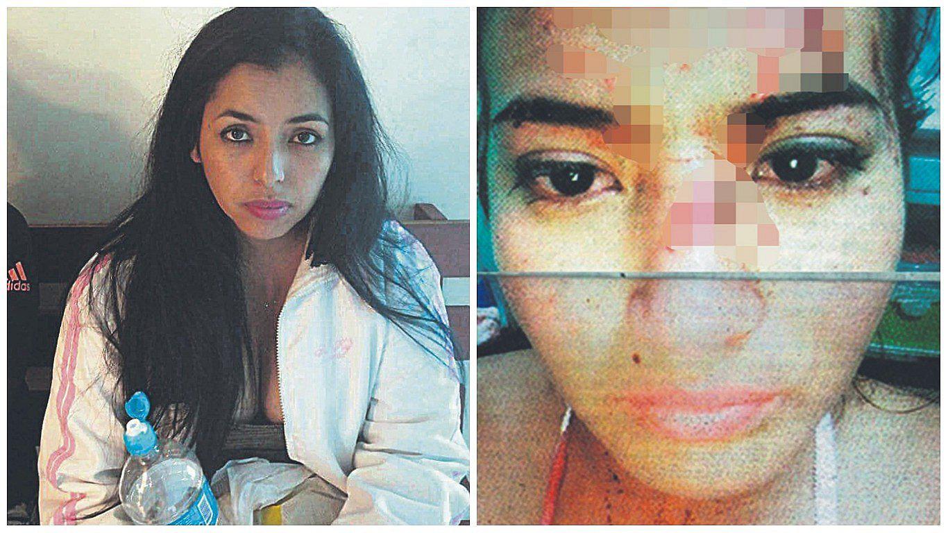 Capturan a acusada de desfigurar a ecuatoriana