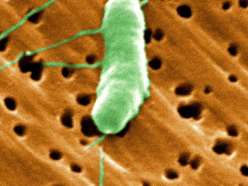 Bacteria que devora carne deja dos muertos en Estados Unidos