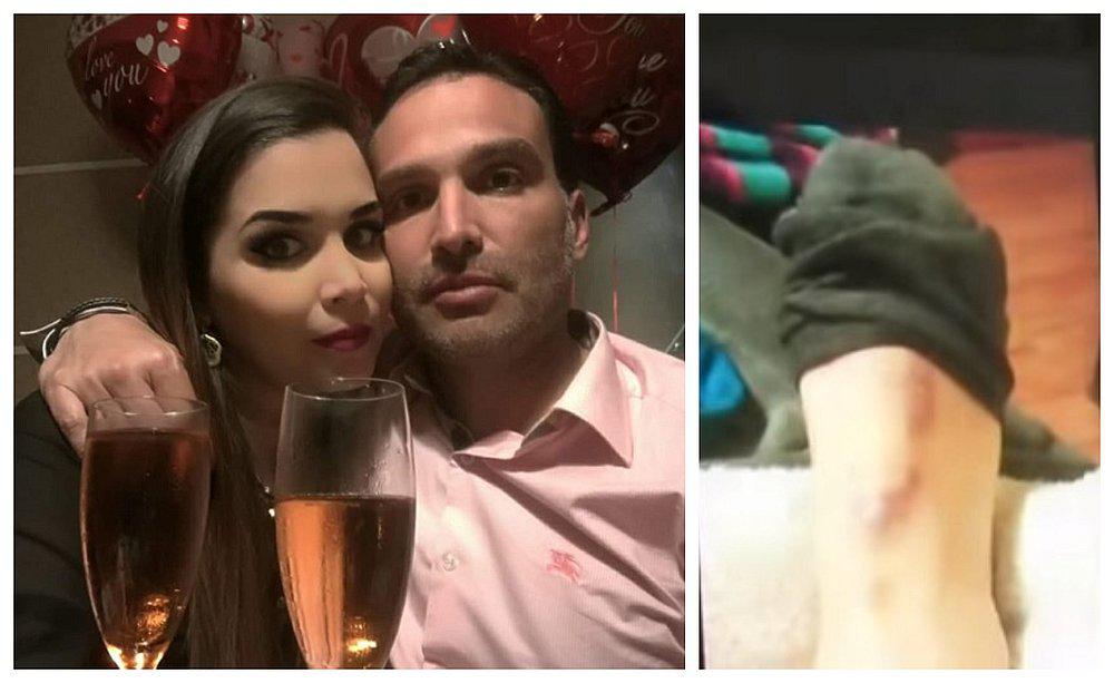 Modelo víctima de agresión brutal de su expareja pide justicia (VIDEO)