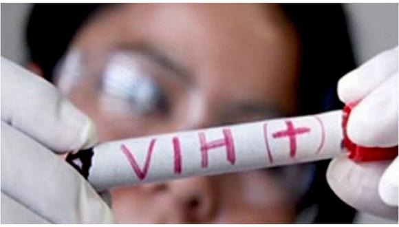 VIH: ​Hallan mutación genética que bloquea una vía de entrada en organismo