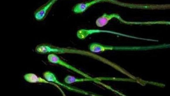 Crean por primera vez células de esperma en laboratorio