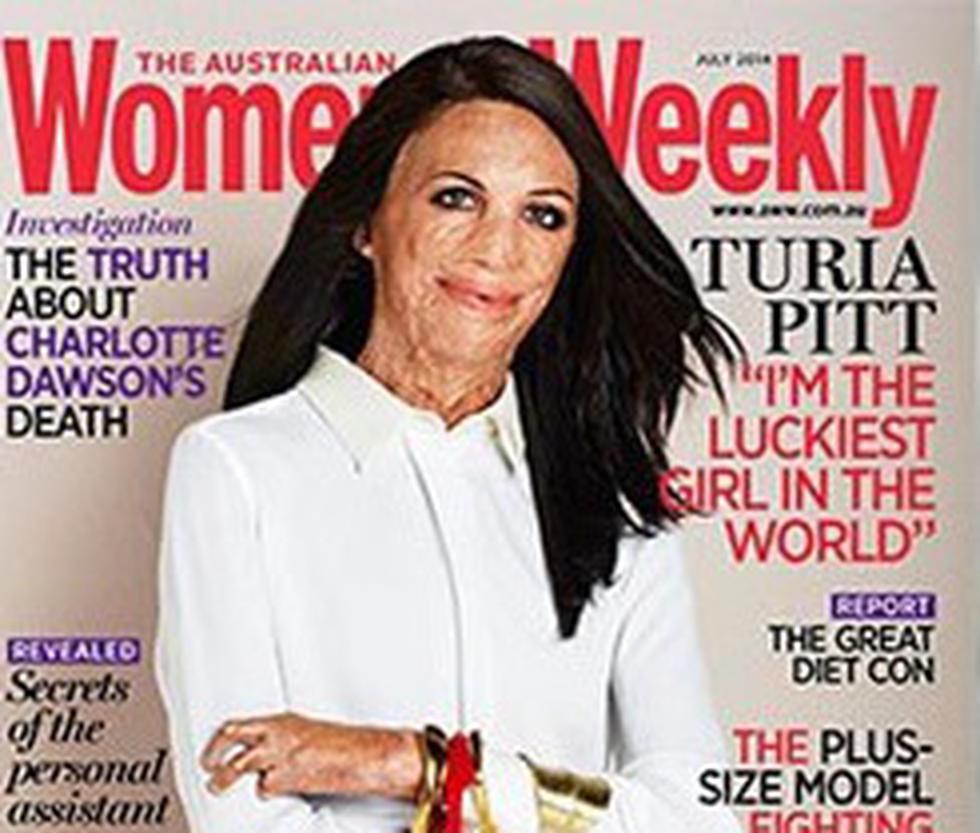 Mujer con quemaduras es elegida para portada de revista (FOTOS)