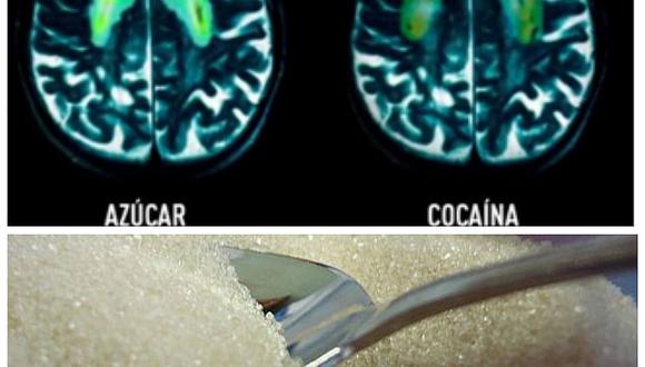 El azúcar provoca los mismos efectos que la cocaína en el cerebro