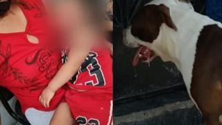 Huaura: Niña de dos años quedó desfigurada tras ser atacada por perro pitbull