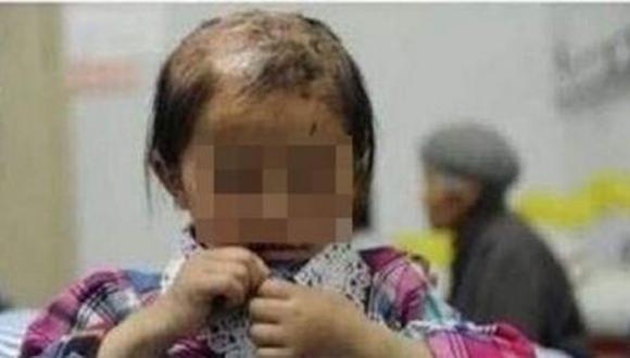 China: Hombre golpeó y cosió la boca a su hija (FOTO)