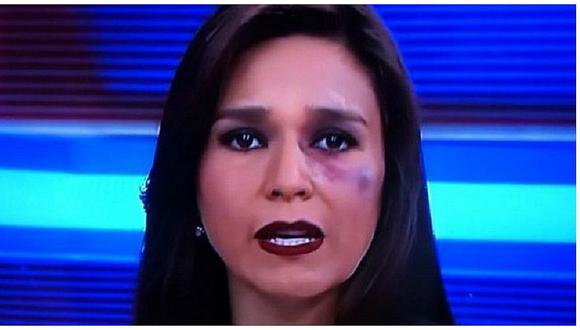 Verónica Linares presentó noticias con moretón en la cara ¿Qué sucedió? (VIDEO)