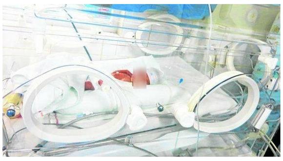 Piden Ayuda Para Bebé De 5 Meses De Nacido Que Urge De Medicina Edicion Correo 3798