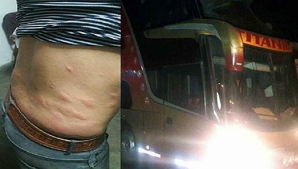 Chimbote: Ómnibus estaba infestado de chinches y pasajeros obligan a detenerlo
