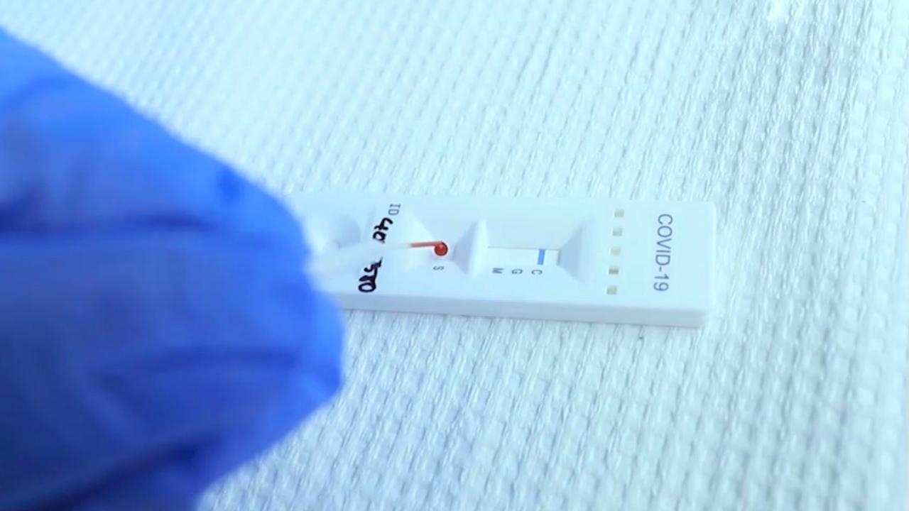 La prueba rápida solo podrá realizarse en casa o vivienda, si es a través de personal de Minsa o de sus dependencias autorizadas. (MINSA)