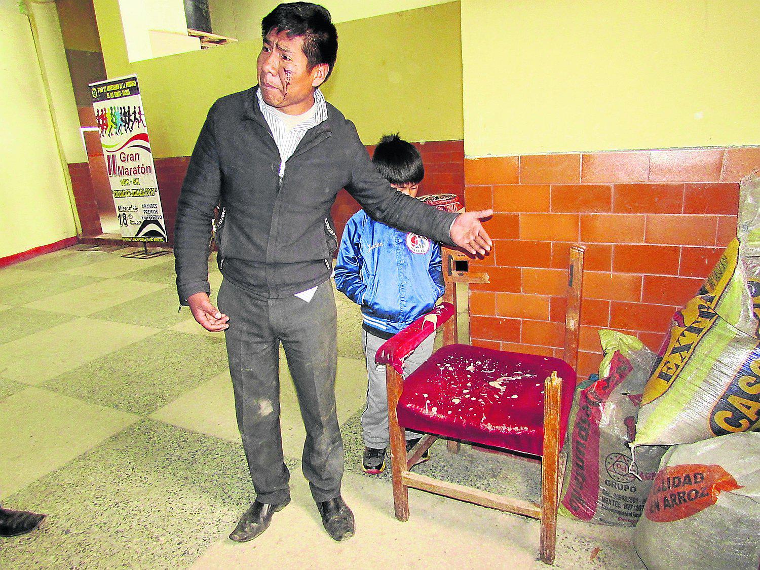 Joven denuncia haber sido golpeado por serenos municipales