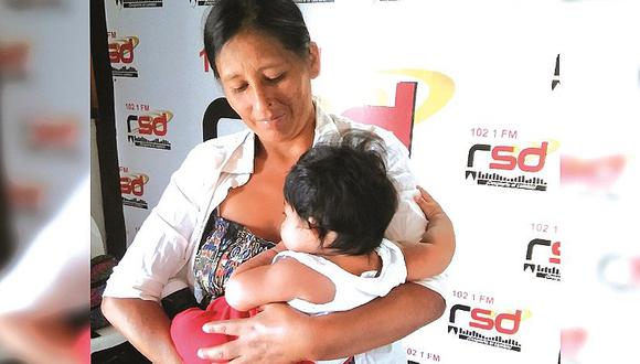 Chimbote: Madre pide ayuda para bebé con malformación