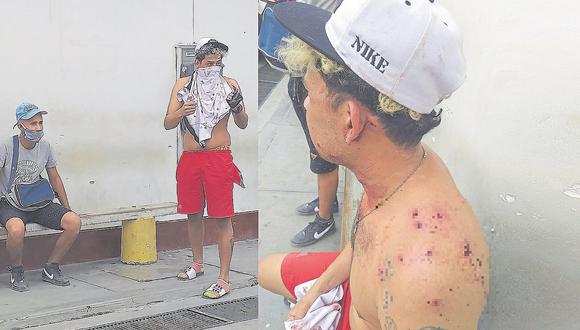 Venezolanos y ama de casa heridos con perdigonera
