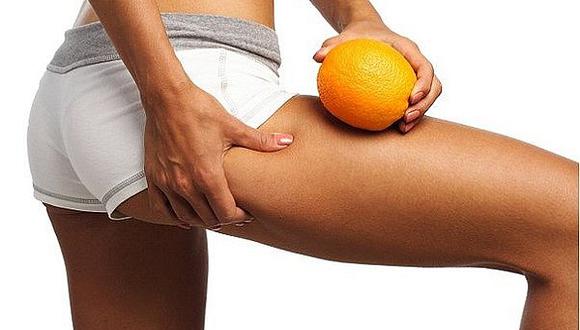 ​Aprenda cómo combatir la celulitis con este remedio casero