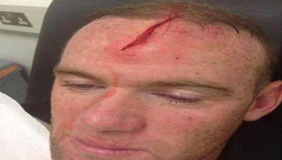 Wayne Rooney sufrió terrible corte en la frente