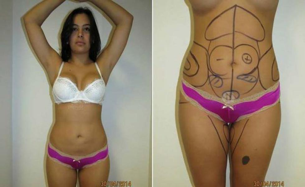 Filtran fotos de Larissa Riquelme antes de cirugía