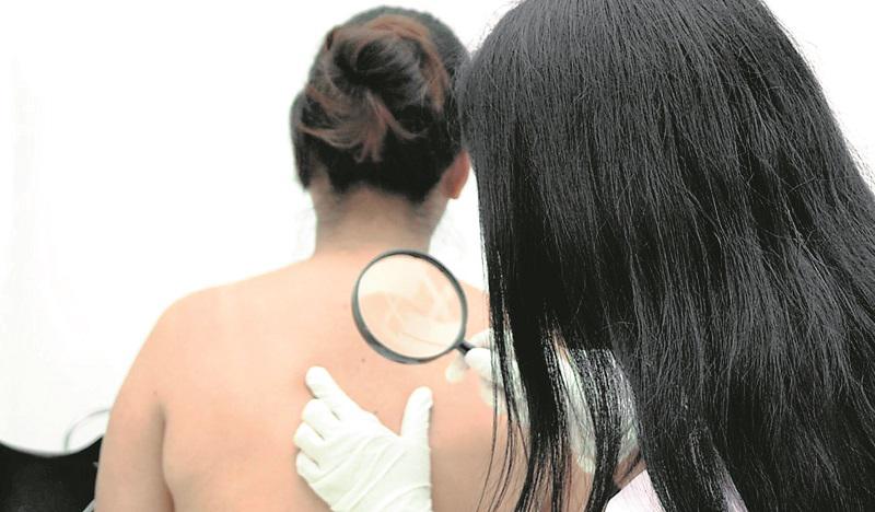 Cáncer (Foto: Andina)