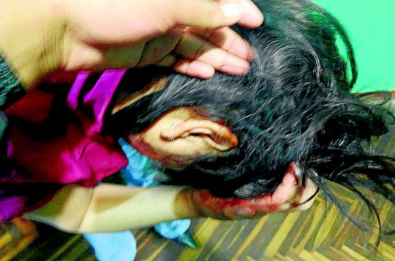 San Román encabeza lista con 397 denuncias por violencia familiar 