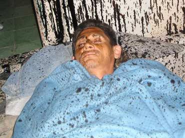 Hospitalizado disidente cubano Jorge Cervantes por huelga de hambre