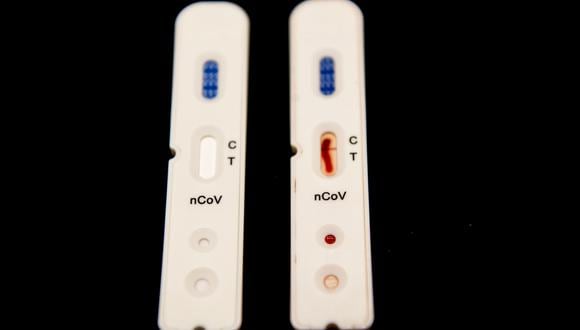 La prueba rápida detecta los anticuerpos que genera el cuerpo cuando ya comienza la infección por el COVID-19. (Foto: Robin UTRECHT / ANP / AFP)