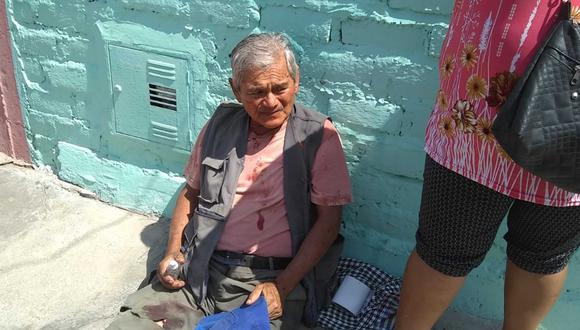 Chincha: Pitbull ataca en el cuello a anciano que caminaba por la calle Colón