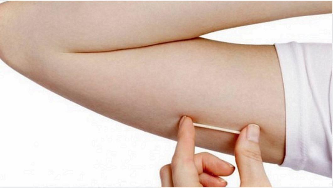 Mujeres podrán acceder a 100 mil implantes anticonceptivos de forma gratuita en Lima