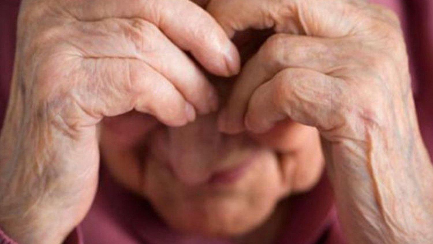 Delincuentes desfiguraron el rostro de una abuelita de 84 años (FOTOS)