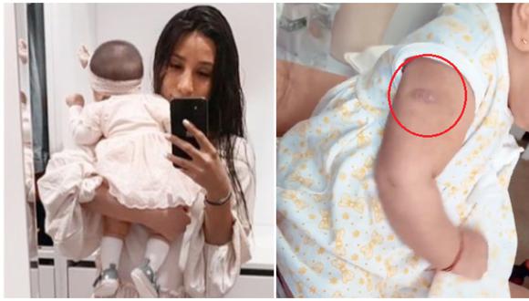 Samahara Lobatón se pronunció sobre la cicatriz que tiene su bebé en el brazo. (Fotos: Instagram)