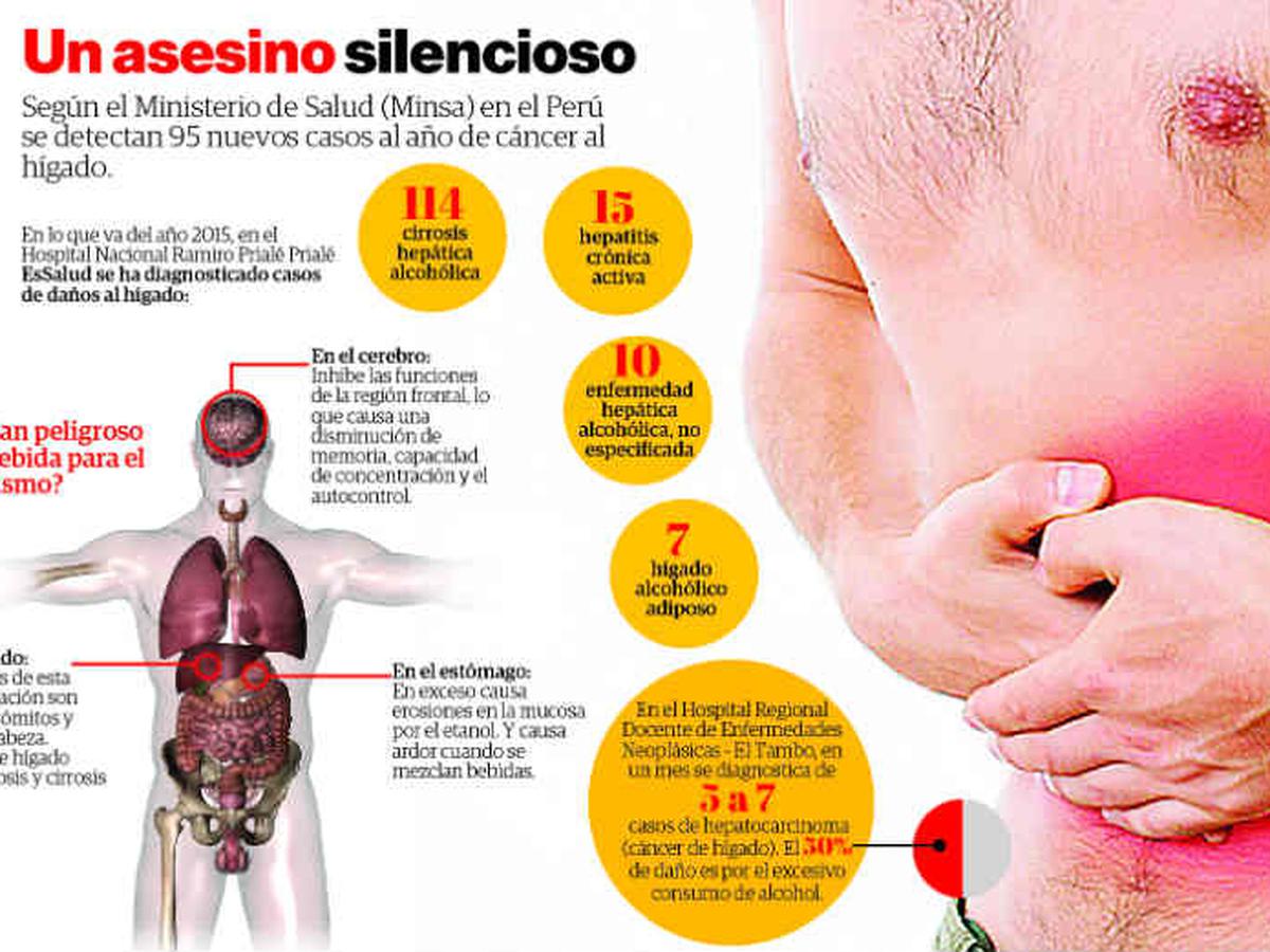 sintomas de cirrosis