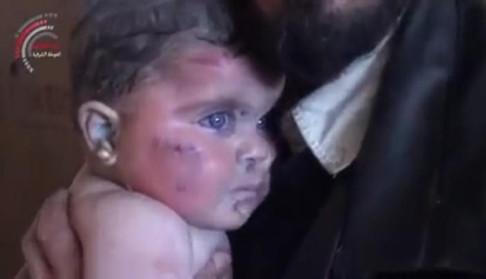 ​Facebook: bebé herida por ataques en Siria conmueve en la red (VIDEO)