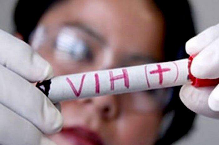Solo el 35% de pacientes con VIH Sida se someten a tratamiento especializado