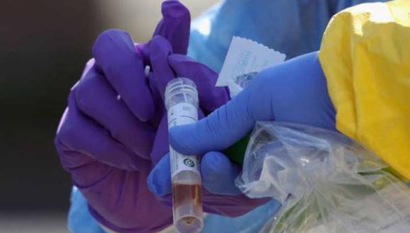 Serán 40 los primeros voluntarios que participarán en las pruebas clínicas que se realizarán en el Centro de Investigación Clínica e Inmunizaciones de la Clínica Universitaria de la UNMSM, informó el infectólogo Eduardo Ticona.