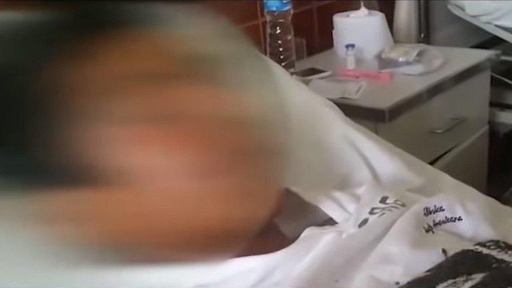 Escolar sobreviviente da detalles del accidente de bus caído en Chachapoyas